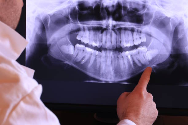 Best Emergency Dental Care for Sports Injuries in Suncook, NH